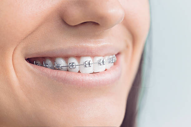 Best Teeth Whitening  in Sanger, TX